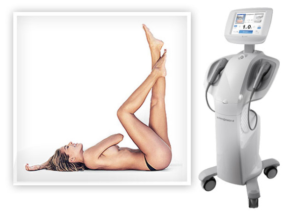 Ultraformer, zabieg ujędrniający