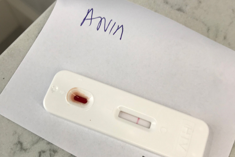 test HIV